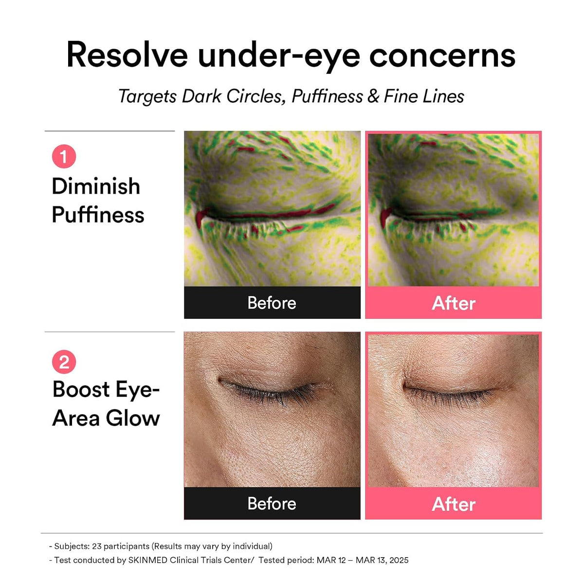 Abib PDRN Retinal Eye Patch Glow Jelly product detail image 4