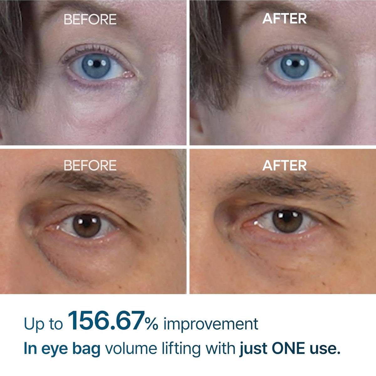 Dr. Melaxin Eyephalt Eyecream for Eyebags product detail image 3